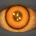 Image of item brimstoneGaze for general information in codex.