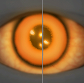 Image of Brimstone Gaze in codex search.