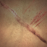 Image of Old Wounds in codex search.