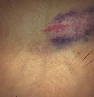 Blunt Force Trauma icon