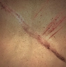 Old Wounds icon