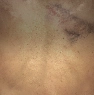 Pockmarks icon