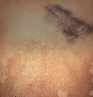 Ship-Scarred icon