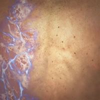 Skyscrawl icon