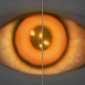 Image of Brimstone Gaze in codex search.