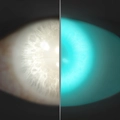 Image of Edge of Madness in codex search.
